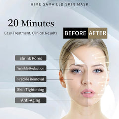 (IMAGES) LED Skin Care Mask for Face and Neck CE-Cleared Pro 7