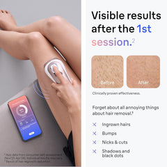 IPL Skin I·Expert, at Home Laser Hair Removal, Holiday Gifts for Women and Men with Free App, Vanity Case, Venus Razor, 4 Smart Heads, PL7387