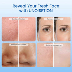 Diamond Microdermabrasion Machine, Dermabrasion Facial Machine for Exfoliation & Blackhead Removal, Home Use Facial Skin Care Equipment