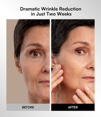 INIA Red Light LED Therapy for Face