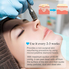 Professional Upgraded Diamond Microdermabrasion Machine MCWDOIT 65-68cm Hg Suction Power