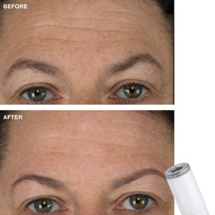 Trophy Skin Device Fine Diamond Tip - Compatible with Any Trophy Skin Microdermabrasion Machine