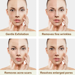 Kendal 3 in 1 Professional Diamond Microdermabrasion Machine
