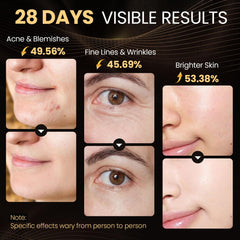 Lovsheme LED Face Mask. Light Therapy for Face Acne, Wrinkles & Skin Rejuvenation.
