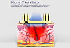 AFit For Multiple Skin Treatments