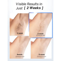 Blex IPL Laser Hair Removal for Women and Men - FDA Cleared