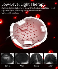 Advanced Red Light Therapy Hair Growth Helmet - Restore Hair Naturally
