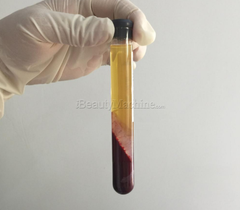 Premium Sterile PRP Kits for Microneedling Procedure